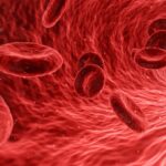 Varicocel - cauze, simptome, tratament