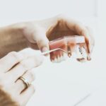 Ai nevoie de implanturi dentare? Află tot ce trebuie să știi despre implantologie.